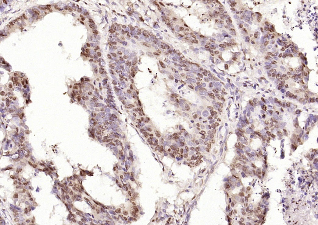 Anti-CIDEC Polyclonal Antibody