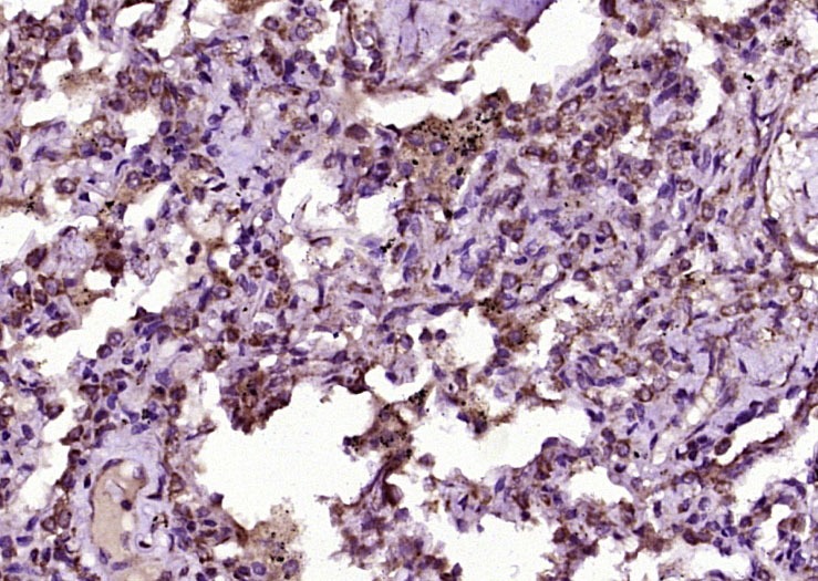 Anti-C-Kit Polyclonal Antibody