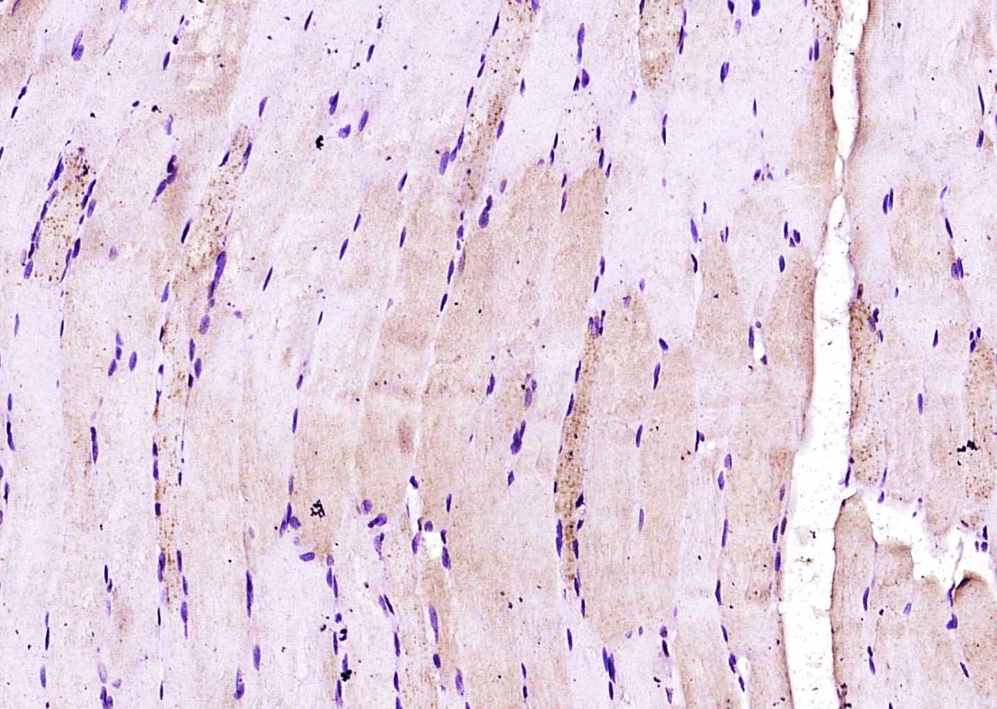 Anti-CRLF1 Polyclonal Antibody