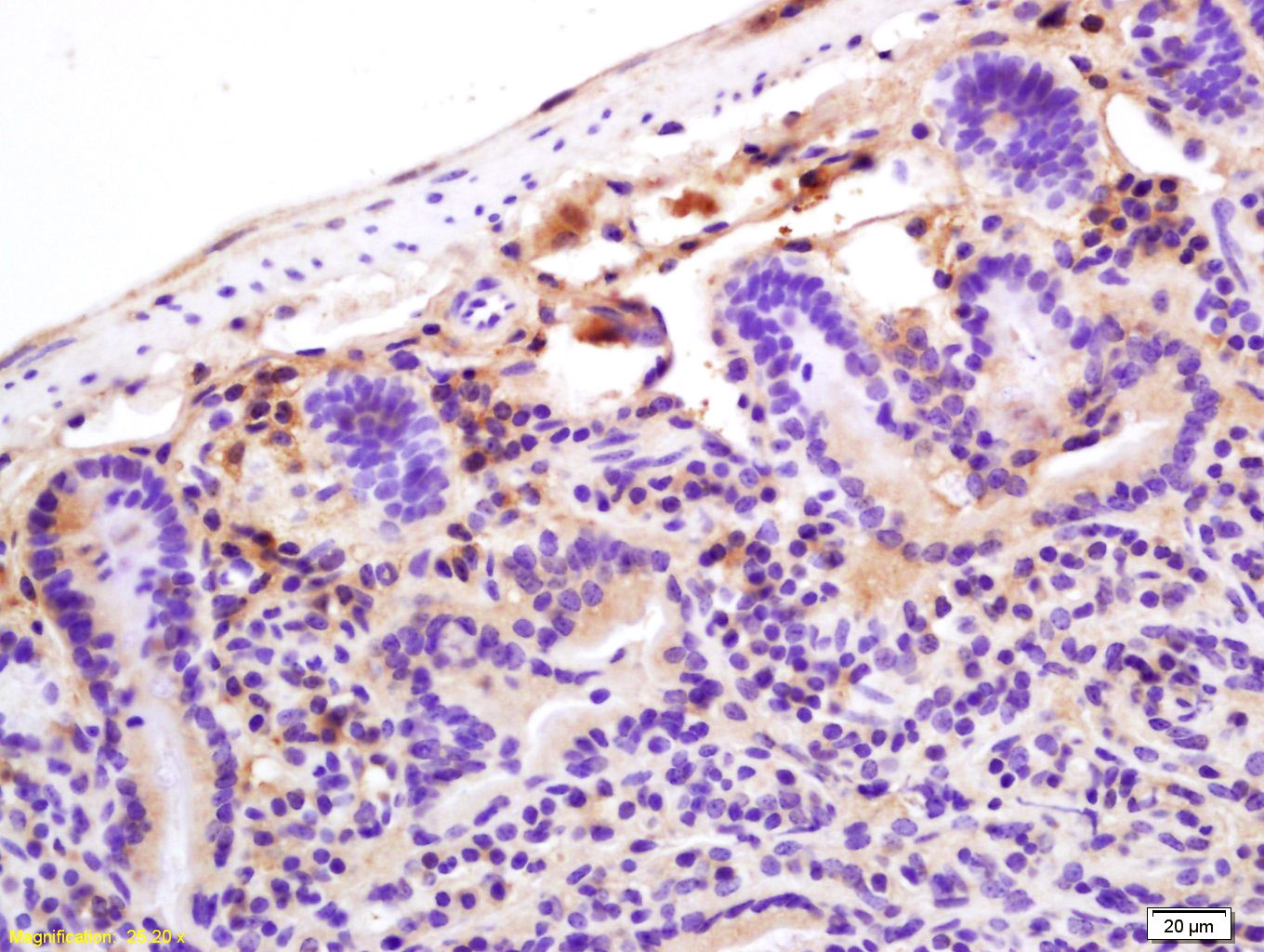 Anti-C-Reactive Polyclonal Antibody