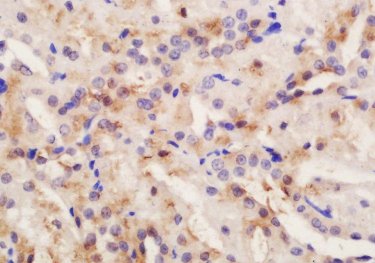 Anti-CRB2 Polyclonal Antibody