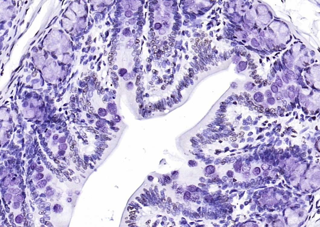 Anti-CIDEC Polyclonal Antibody