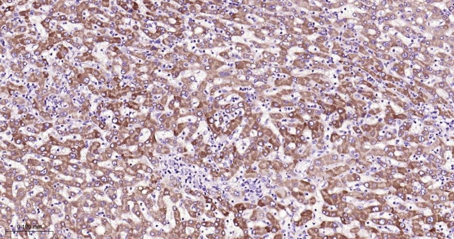 Anti-CPT1A Polyclonal Antibody