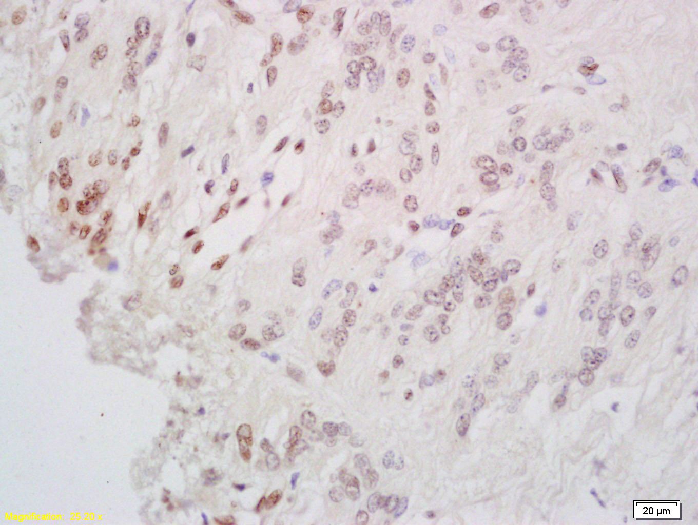 Anti-CREB1 Polyclonal Antibody