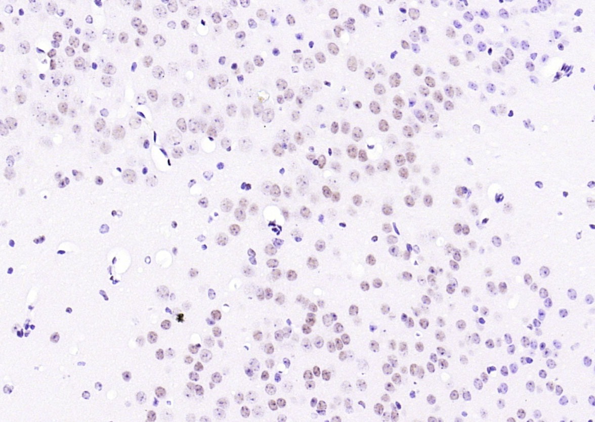 Anti-CREB1 Antibody (3J147)