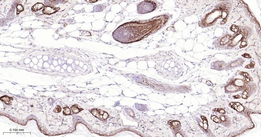 Anti-Claudin-1 Antibody (2P425)
