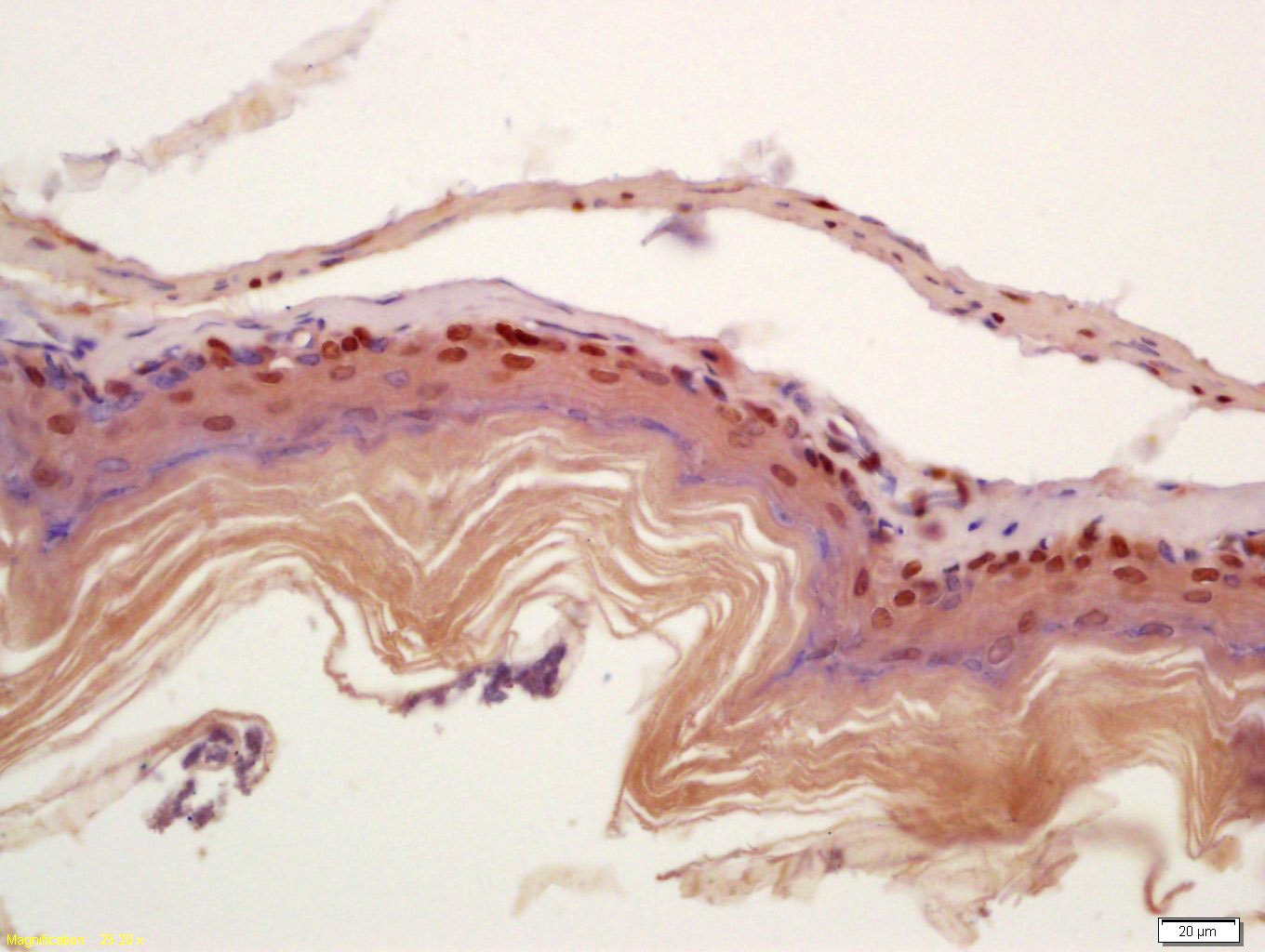 Anti-CIDEC Polyclonal Antibody