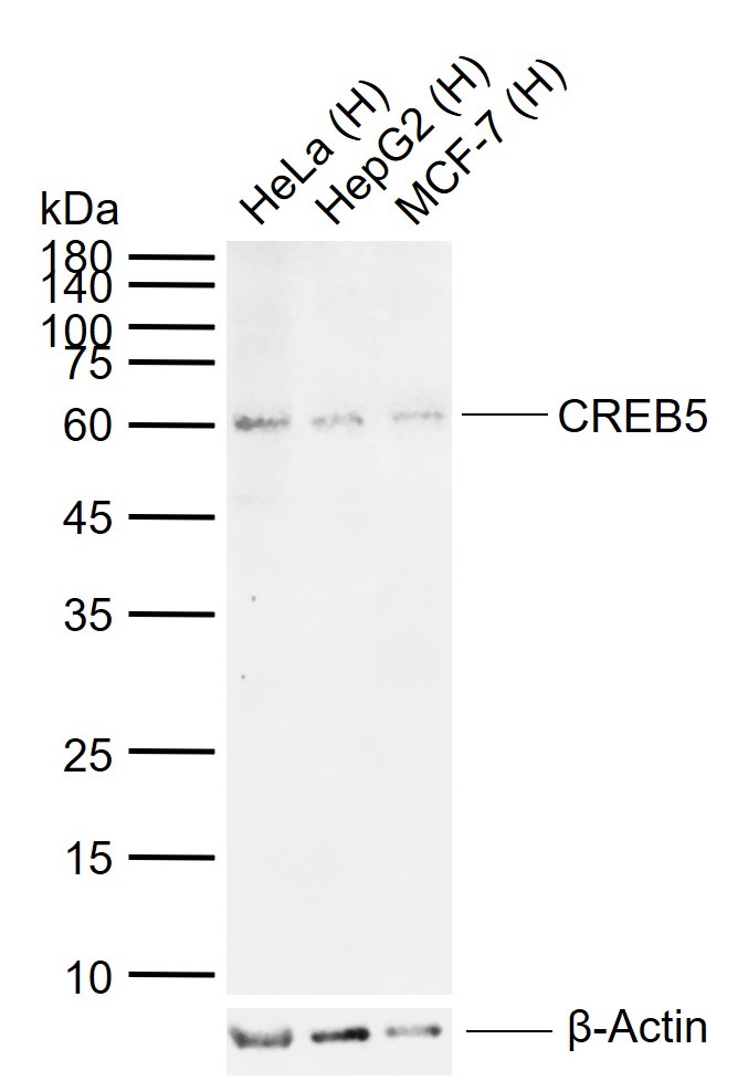 Anti-CREB5 Polyclonal Antibody