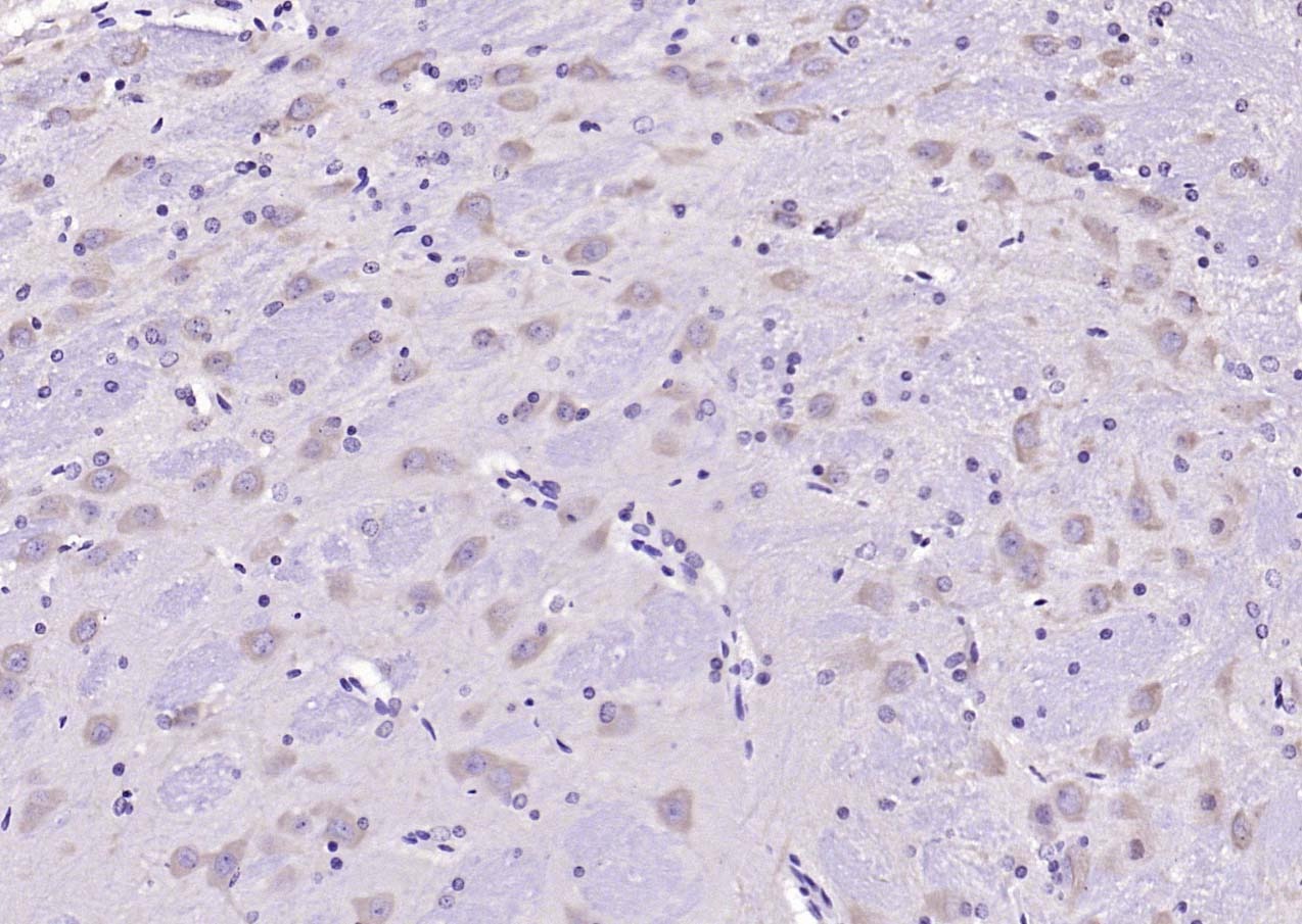Anti-CRHR1 Polyclonal Antibody