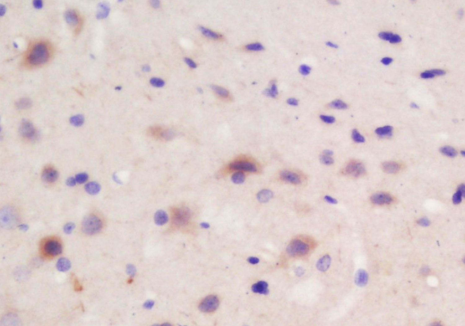 Anti-CRB2 Polyclonal Antibody