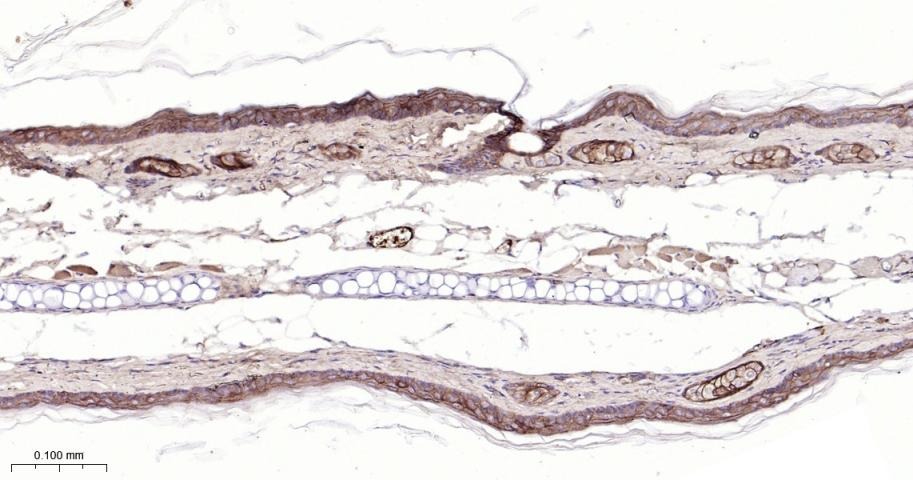 Anti-Claudin-1 Antibody (2P425)