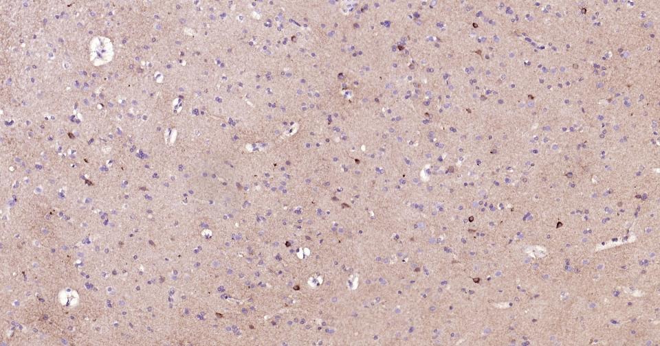 Anti-C-Kit Antibody (7A806)