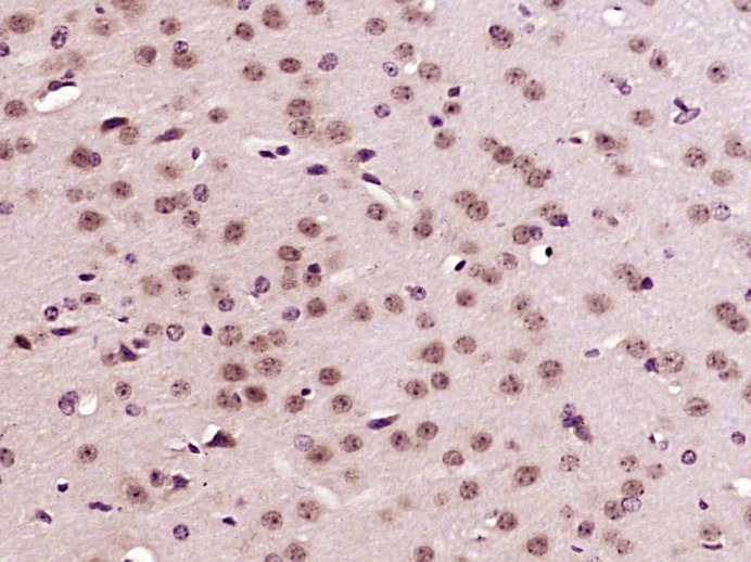 Anti-CREB5 Polyclonal Antibody