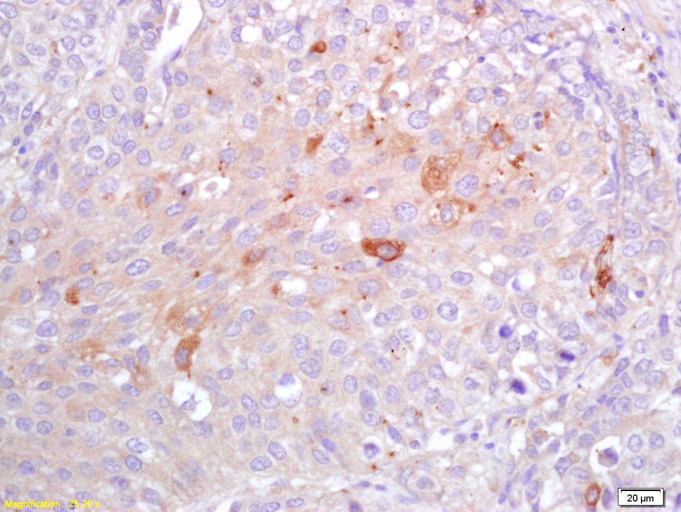 Anti-C-Reactive Polyclonal Antibody