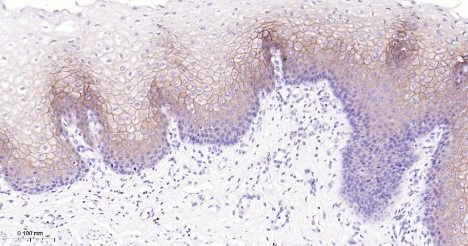 Anti-Claudin-1 Antibody (2P425)