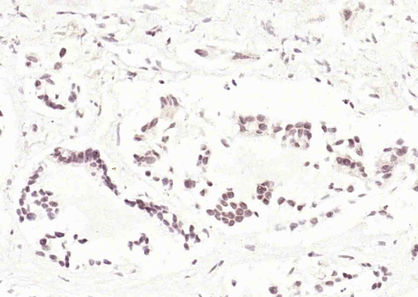 Anti-CDK4 Polyclonal Antibody