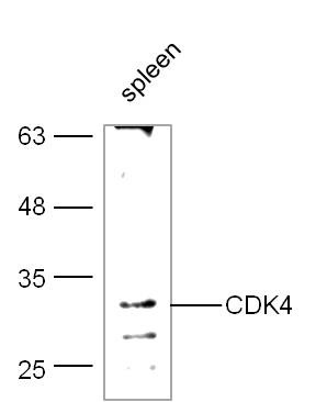 Anti-CDK4 Polyclonal Antibody