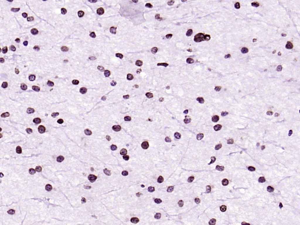 Anti-CDK4 Antibody (6D570)
