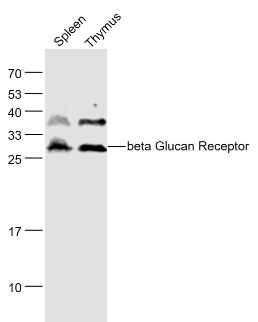 Anti-CLEC7A Polyclonal Antibody 2