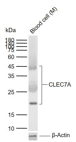 Anti-CLEC7A Polyclonal Antibody
