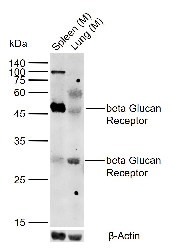 Anti-CLEC7A Polyclonal Antibody 2