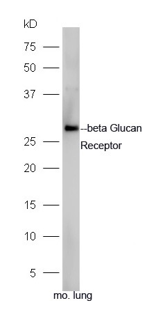Anti-CLEC7A Polyclonal Antibody 2