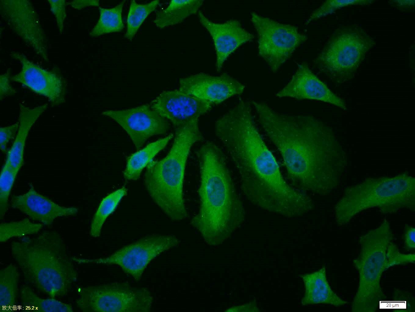 Anti-CDK4 Polyclonal Antibody