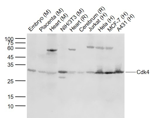 Anti-CDK4 Antibody (6D570)