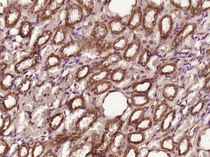 Anti-CDK4 Polyclonal Antibody