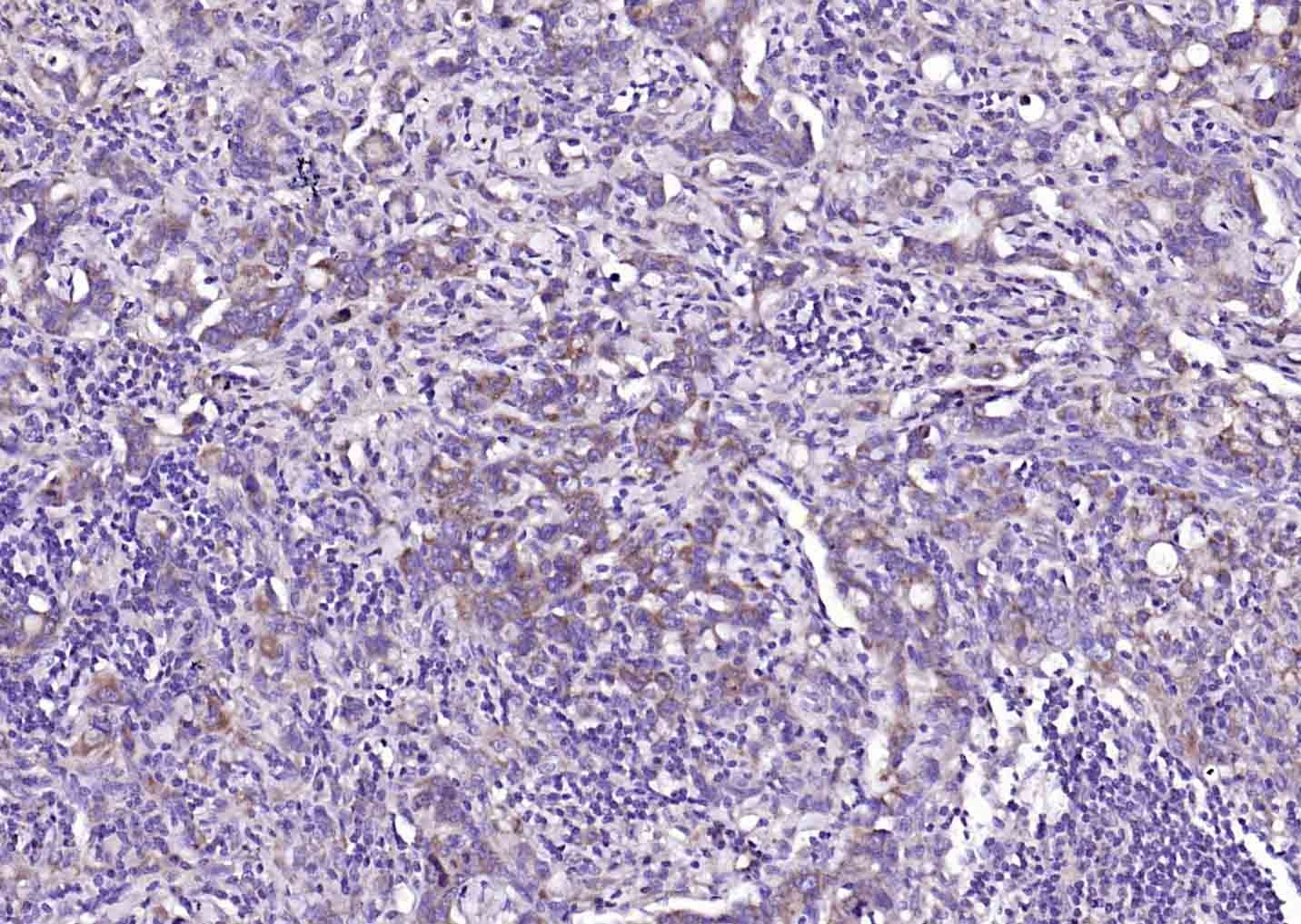 Anti-CLEC5A Polyclonal Antibody