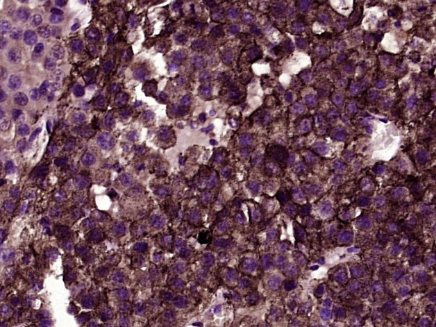 Anti-CSPG4 Polyclonal Antibody