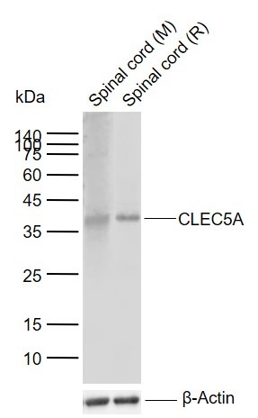 Anti-CLEC5A Polyclonal Antibody