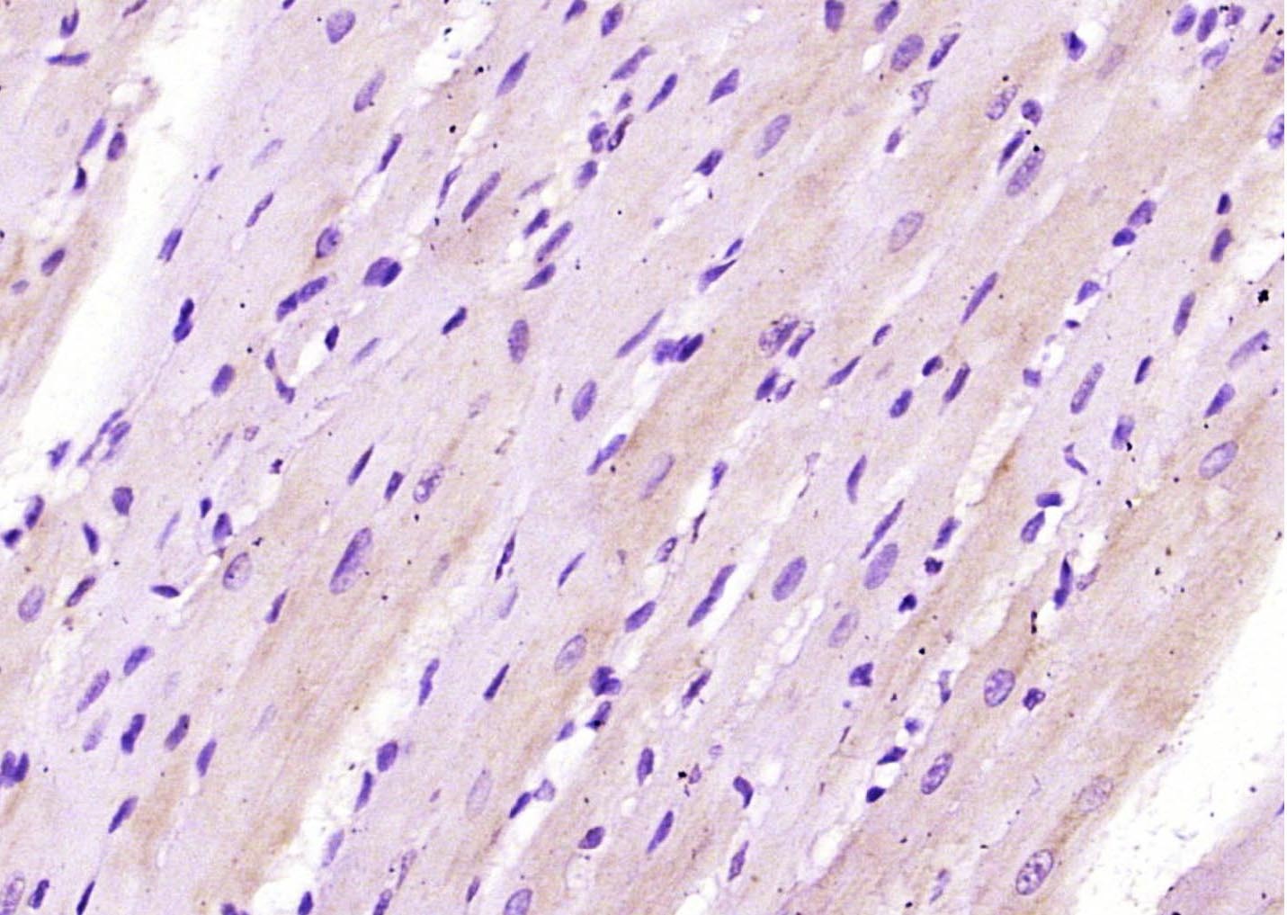 Anti-CRLF1 Polyclonal Antibody