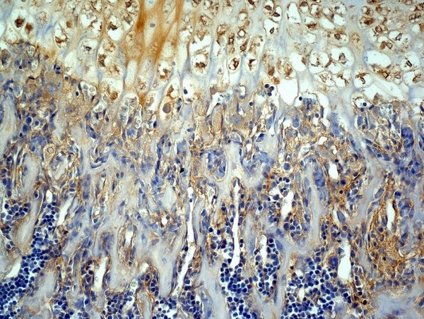 Anti-MMP-13 Polyclonal Antibody