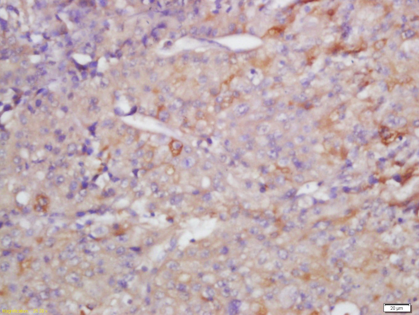 Anti-MMP-13 Polyclonal Antibody 3