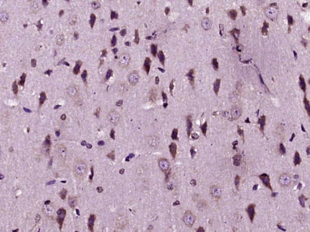 Anti-MMP-1 Polyclonal Antibody 2
