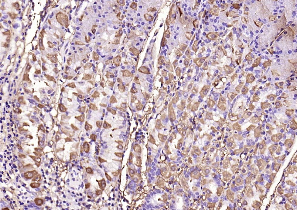 Anti-MMP-1 Polyclonal Antibody 2