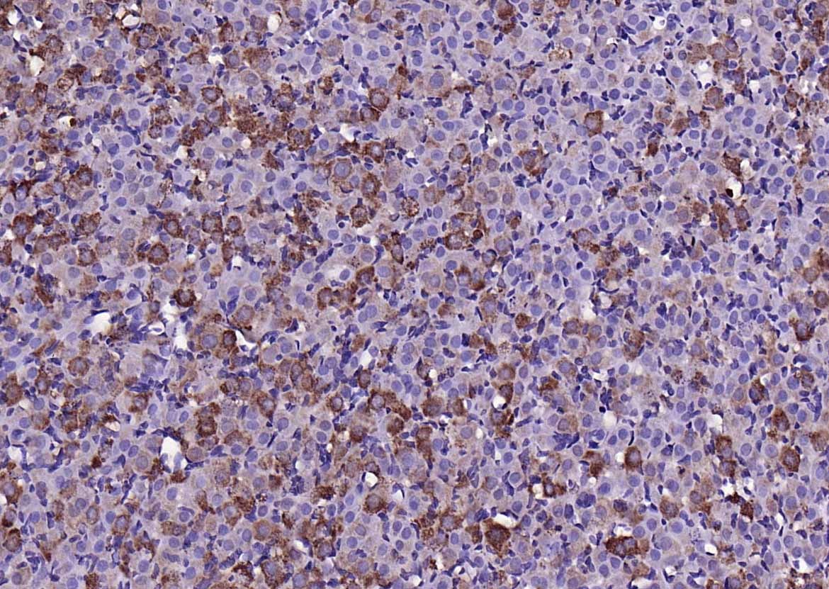 Anti-MMP-1 Polyclonal Antibody 2