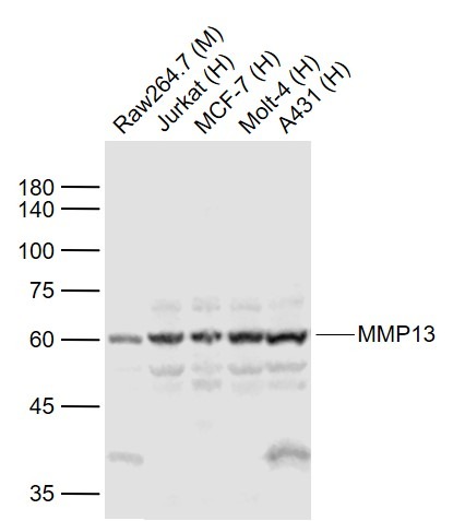 Anti-MMP-13 Polyclonal Antibody 3