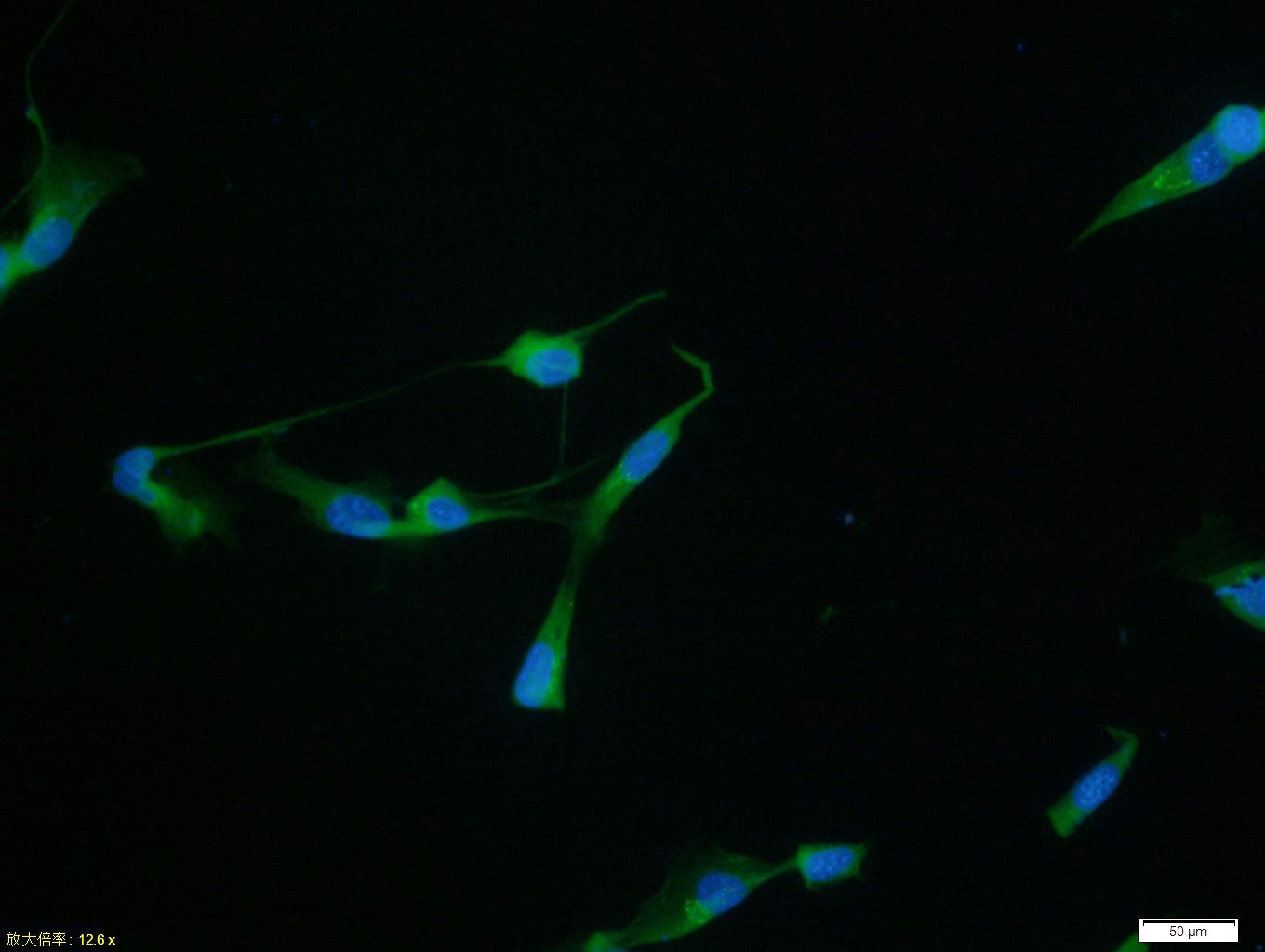 Anti-MMP-2 Polyclonal Antibody 2