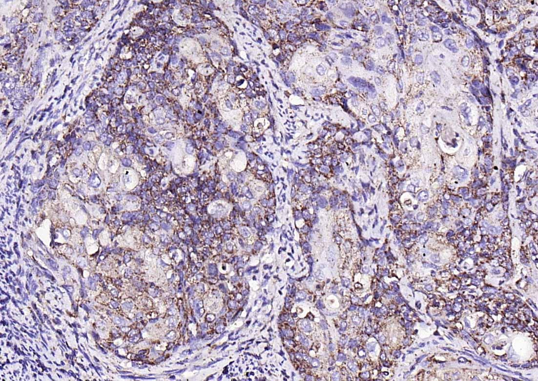 Anti-MMP-1 Polyclonal Antibody 2
