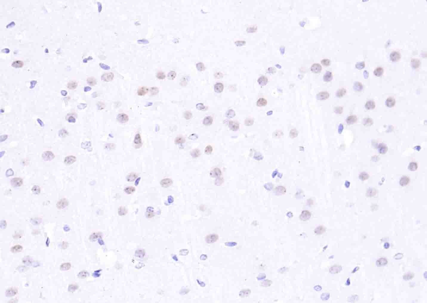 Anti-H2AFX Polyclonal Antibody