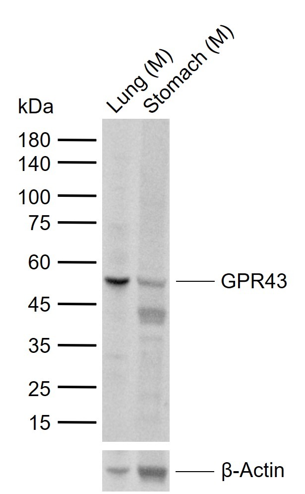 Anti-GPR43 Polyclonal Antibody 2