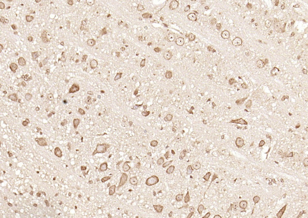 Anti-GPR30 Polyclonal Antibody 2