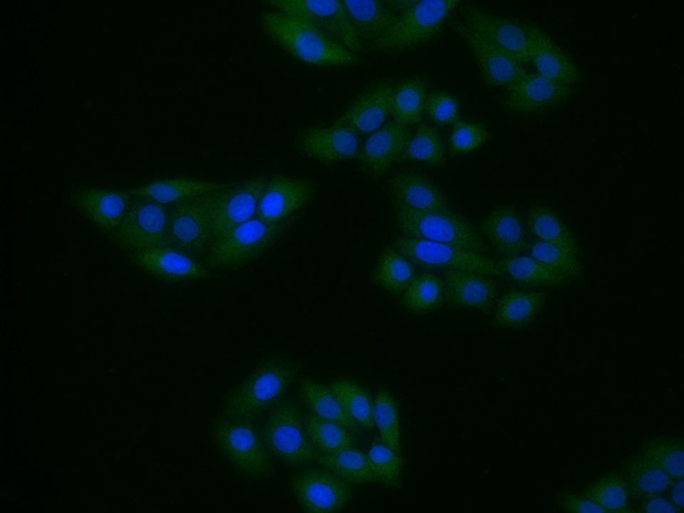 Anti-GPR43 Polyclonal Antibody