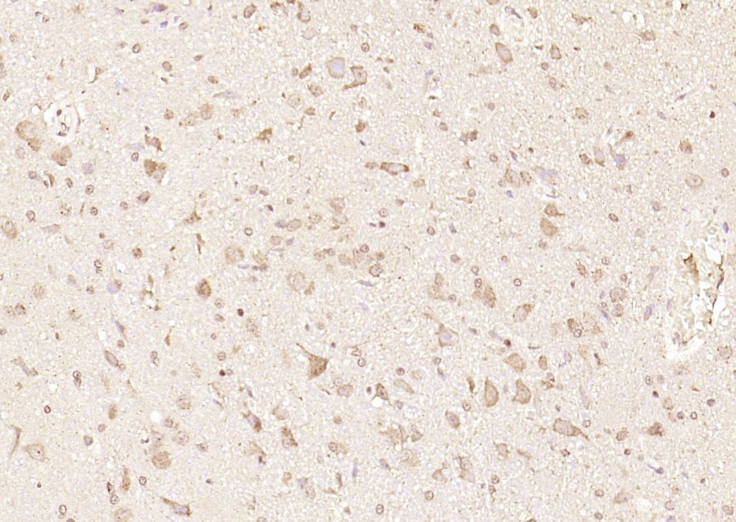 Anti-GPR30 Polyclonal Antibody 2