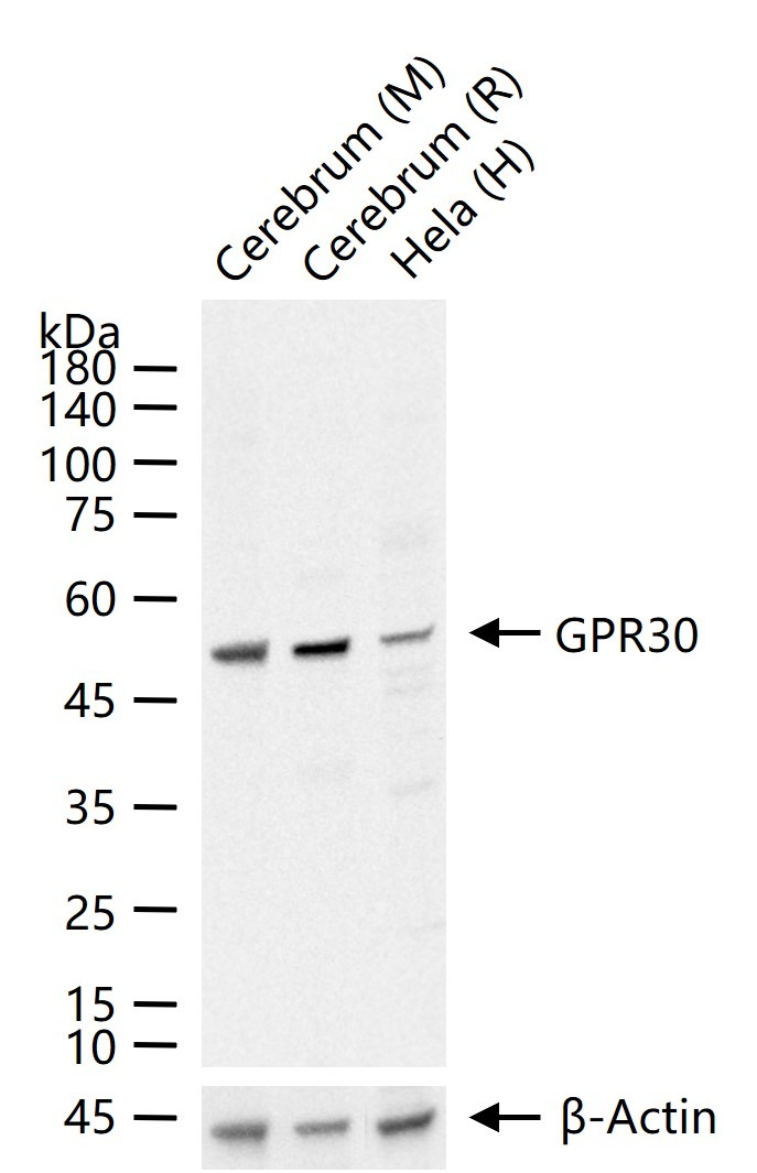 Anti-GPR30 Polyclonal Antibody 2