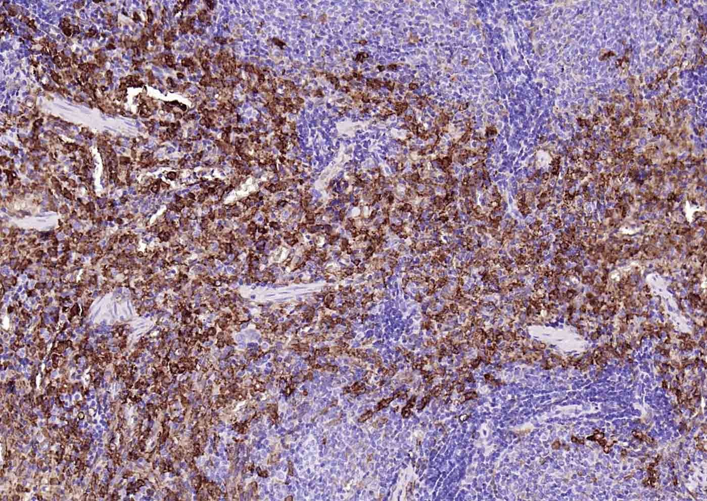 Anti-HMOX1 Antibody (9D115)