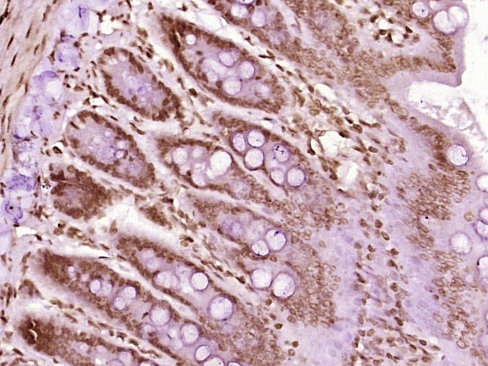 Anti-HNRNPA2B1 Polyclonal Antibody