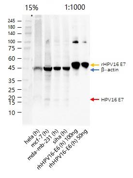 Anti-HPV16 E7 Polyclonal Antibody 2
